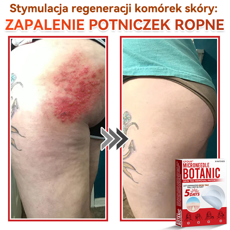 🎁 🎁Zostało już tylko 5 opakowań! Oferujemy dodatkowe 50% zniżki! Bądź w formie i dbaj o zdrowie! Skorzystaj z okazji już teraz, bo do przyszłego roku nie będzie kolejnej szansy.