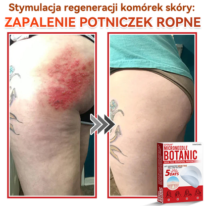 🎁 🎁Zostało już tylko 5 opakowań! Oferujemy dodatkowe 50% zniżki! Bądź w formie i dbaj o zdrowie! Skorzystaj z okazji już teraz, bo do przyszłego roku nie będzie kolejnej szansy.