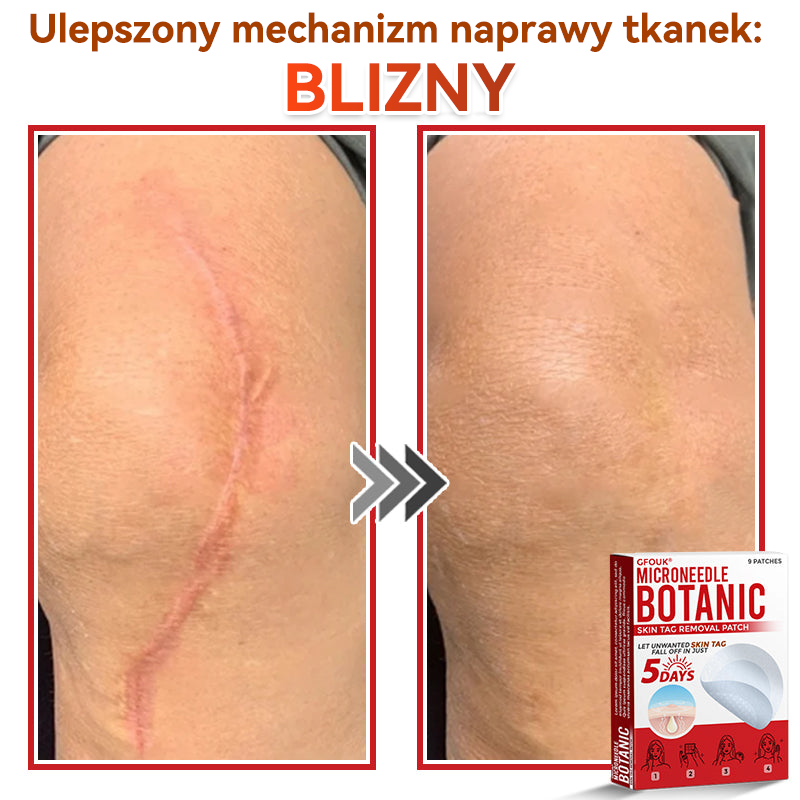 🎁 🎁Zostało już tylko 5 opakowań! Oferujemy dodatkowe 50% zniżki! Bądź w formie i dbaj o zdrowie! Skorzystaj z okazji już teraz, bo do przyszłego roku nie będzie kolejnej szansy.
