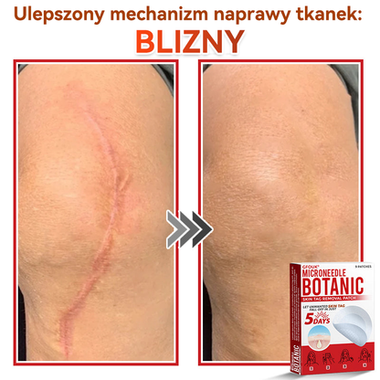 🎁 🎁Zostało już tylko 5 opakowań! Oferujemy dodatkowe 50% zniżki! Bądź w formie i dbaj o zdrowie! Skorzystaj z okazji już teraz, bo do przyszłego roku nie będzie kolejnej szansy.