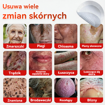🎁 🎁Zostało już tylko 5 opakowań! Oferujemy dodatkowe 50% zniżki! Bądź w formie i dbaj o zdrowie! Skorzystaj z okazji już teraz, bo do przyszłego roku nie będzie kolejnej szansy.