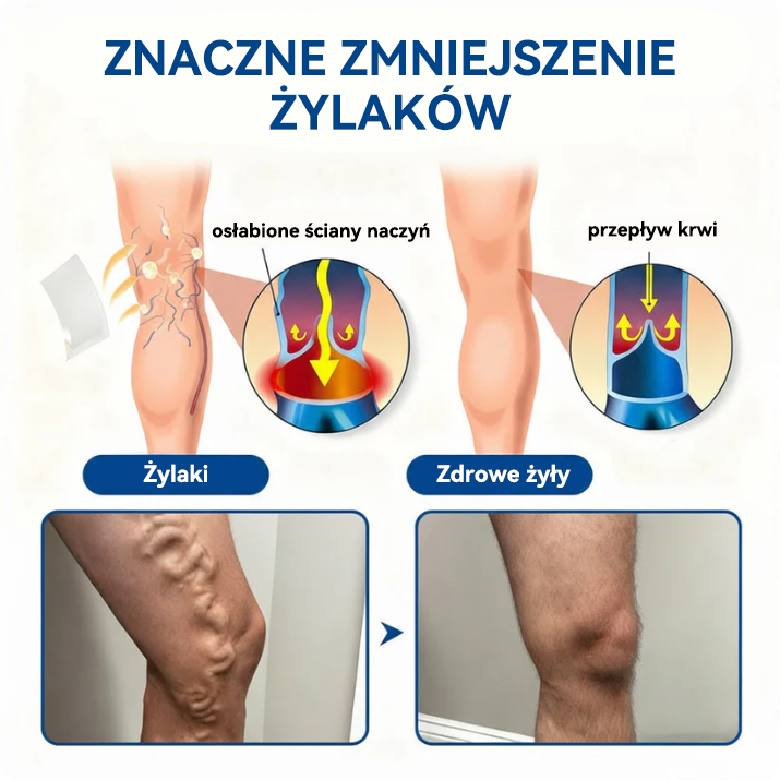 🎁 Zostało już tylko 5 opakowań! Oferujemy dodatkowe 50% zniżki! Bądź w formie i dbaj o zdrowie! Skorzystaj z okazji już teraz, bo do przyszłego roku nie będzie kolejnej szansy.
