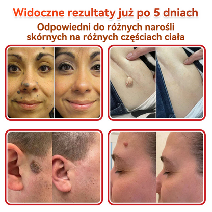 🎁 🎁Zostało już tylko 5 opakowań! Oferujemy dodatkowe 50% zniżki! Bądź w formie i dbaj o zdrowie! Skorzystaj z okazji już teraz, bo do przyszłego roku nie będzie kolejnej szansy.