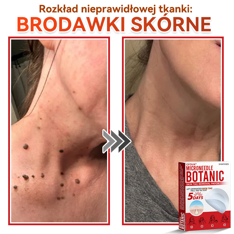 🎁 🎁Zostało już tylko 5 opakowań! Oferujemy dodatkowe 50% zniżki! Bądź w formie i dbaj o zdrowie! Skorzystaj z okazji już teraz, bo do przyszłego roku nie będzie kolejnej szansy.