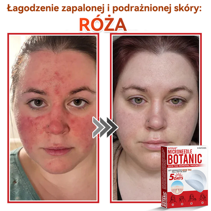 🎁 🎁Zostało już tylko 5 opakowań! Oferujemy dodatkowe 50% zniżki! Bądź w formie i dbaj o zdrowie! Skorzystaj z okazji już teraz, bo do przyszłego roku nie będzie kolejnej szansy.