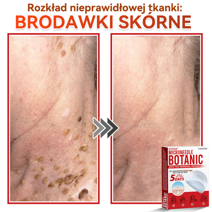 🎁 🎁Zostało już tylko 5 opakowań! Oferujemy dodatkowe 50% zniżki! Bądź w formie i dbaj o zdrowie! Skorzystaj z okazji już teraz, bo do przyszłego roku nie będzie kolejnej szansy.