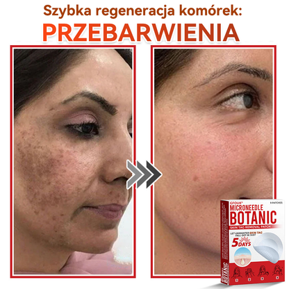 🎁 🎁Zostało już tylko 5 opakowań! Oferujemy dodatkowe 50% zniżki! Bądź w formie i dbaj o zdrowie! Skorzystaj z okazji już teraz, bo do przyszłego roku nie będzie kolejnej szansy.