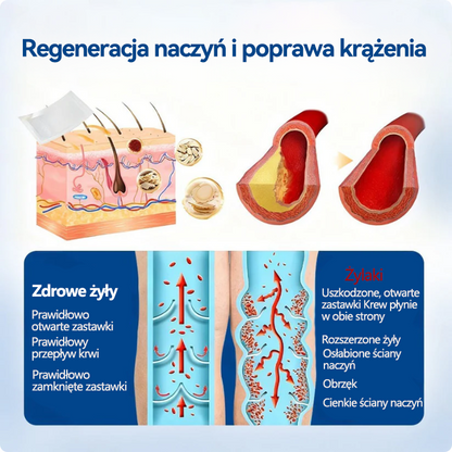 🏅🇵🇱👨‍⚕️✅TAILEDEN® VeinEase Plastry z Mikronakłuciami⚡Natychmiastowa ulga, długotrwałe rezultaty.z