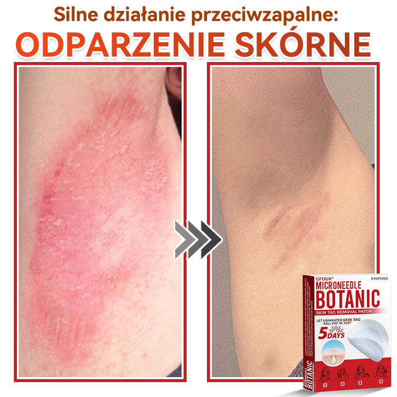 🎁 🎁Zostało już tylko 5 opakowań! Oferujemy dodatkowe 50% zniżki! Bądź w formie i dbaj o zdrowie! Skorzystaj z okazji już teraz, bo do przyszłego roku nie będzie kolejnej szansy.